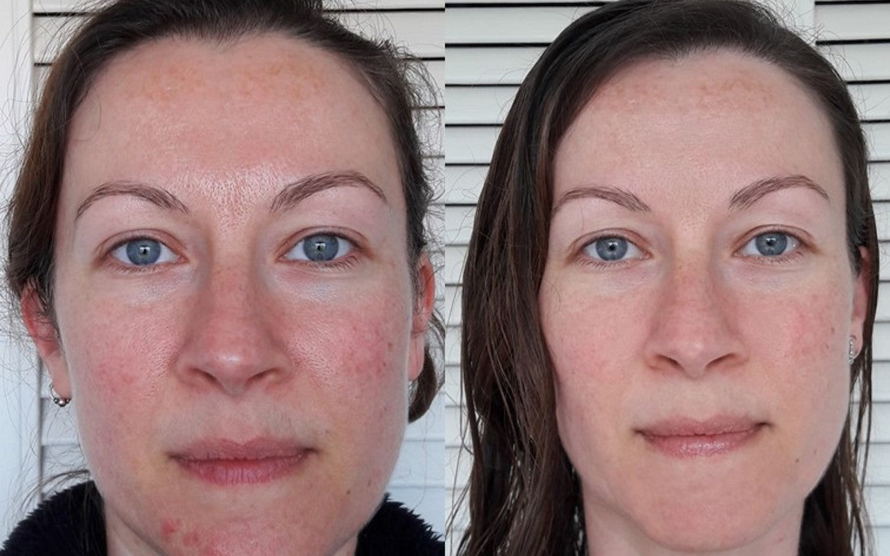 UpCircle before and afters