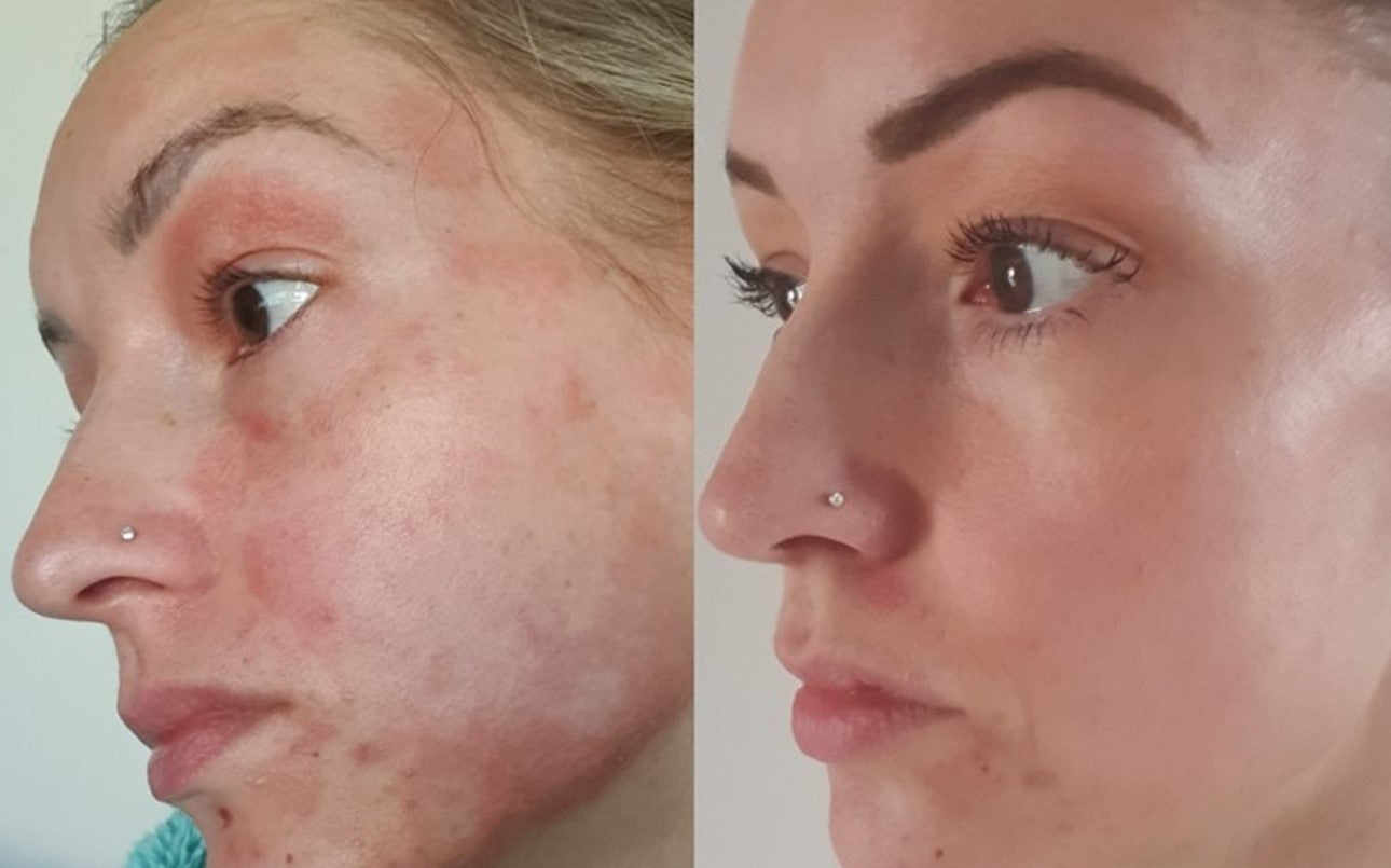 More UpCircler skin transformations!