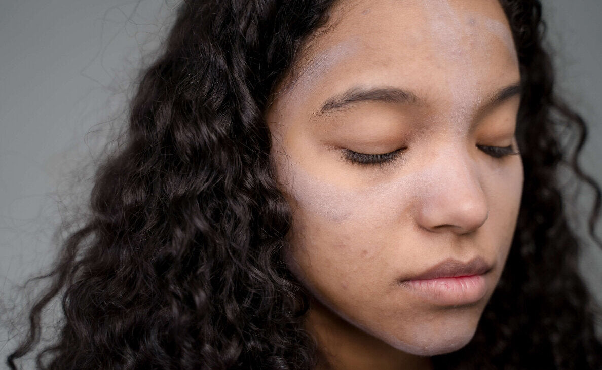 A guide to the different facial skin conditions