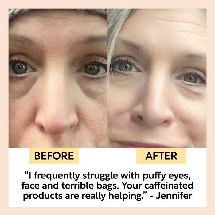 small product image-6,Eye Cream customer before and after: puffy eyes and bags