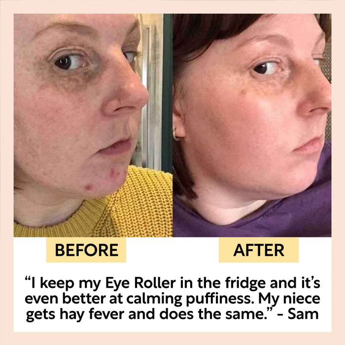 product image-7,Eye Roller customer before and after, kept in the fridge for calming puffiness