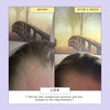 product image-4,Scalp + Hair Oil with Bacuri Butter + Castor Oil