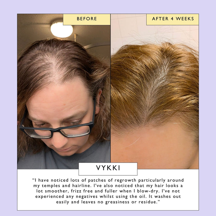 small product image-9,Scalp + Hair Oil with Bacuri Butter + Castor Oil