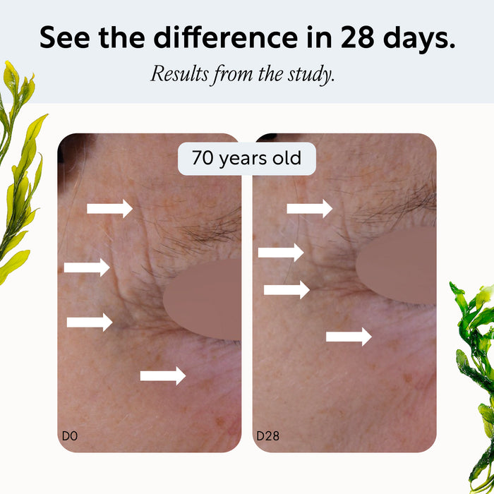 product image-5,Opal Alga seaweed extract study, day 0 and day 28